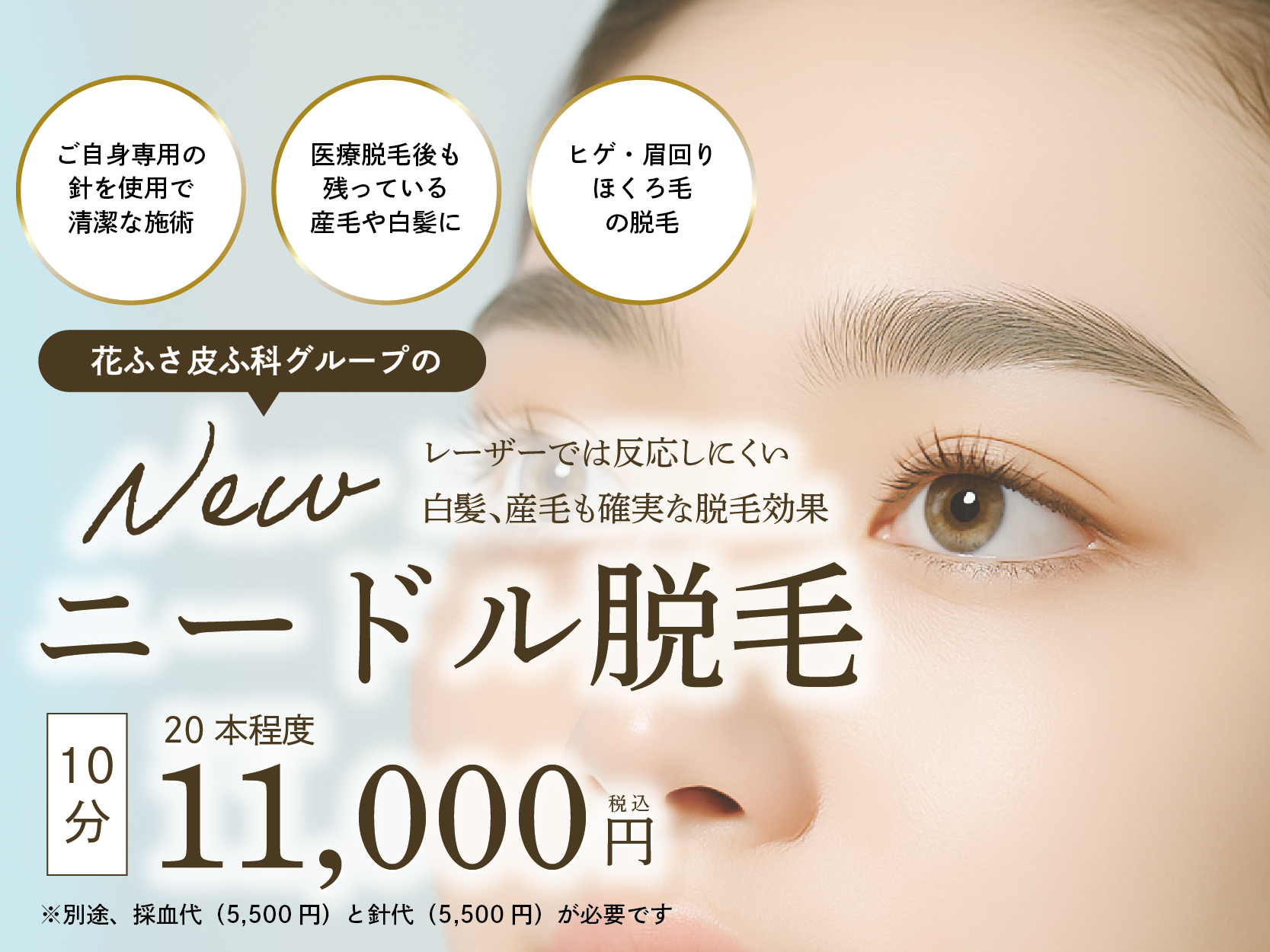 ニードル脱毛キャンペーン