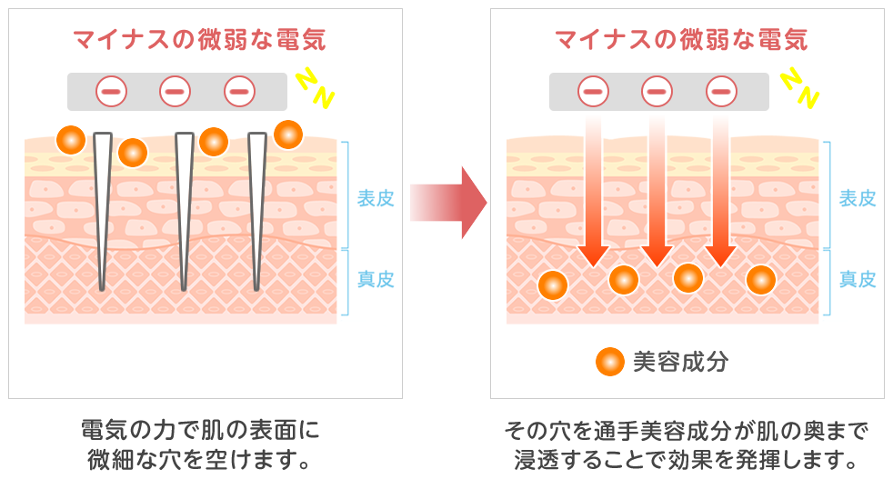 メソアクティスのしくみ