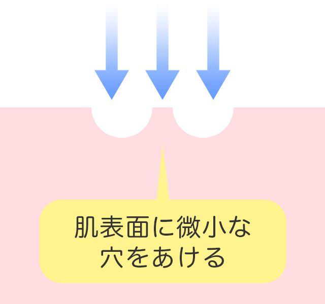 他の治療方法との違い