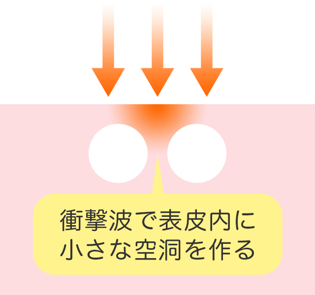 他の治療方法との違い
