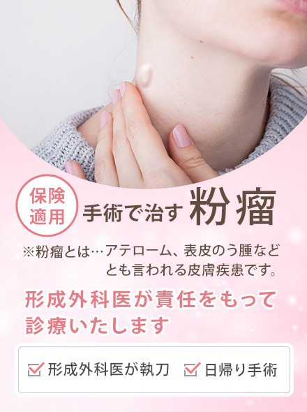 形成外科専門医による粉瘤手術について