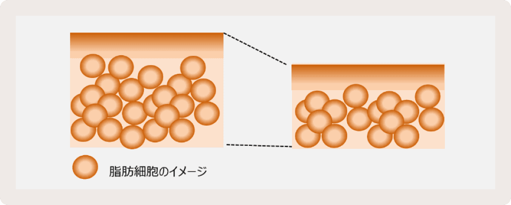 クールスカルプティング