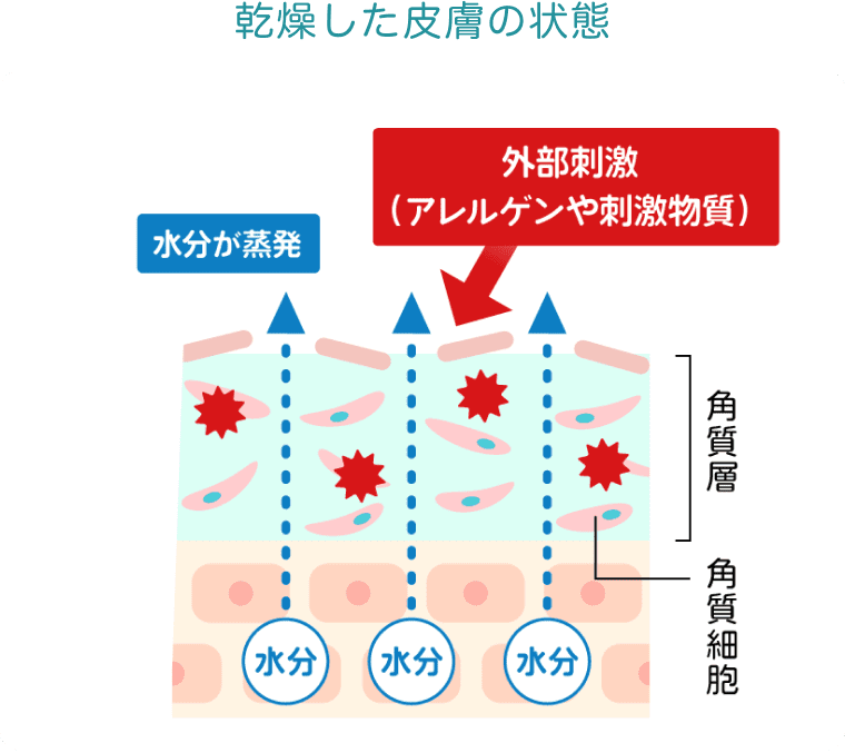 乾燥した皮膚の状態