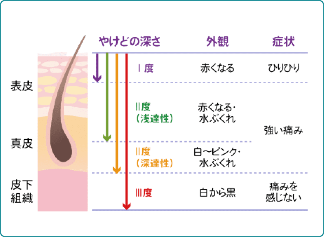 やけど