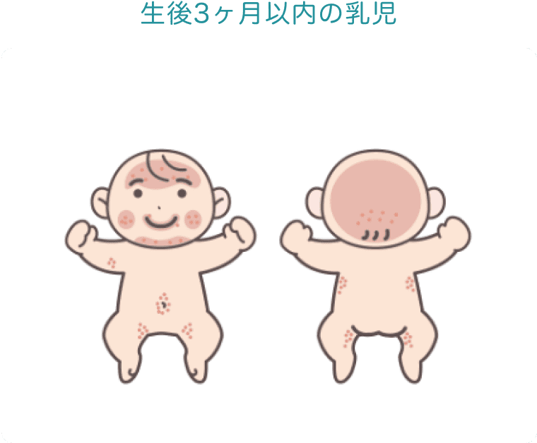 生後3ヶ月以内の乳児