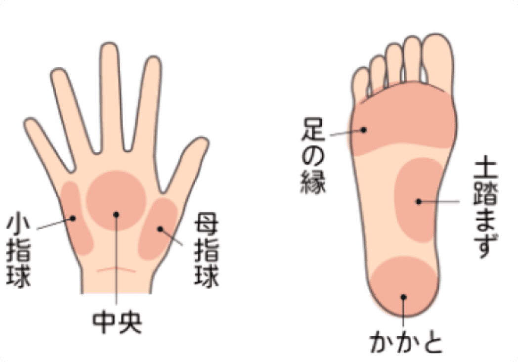 帯状疱疹の症状